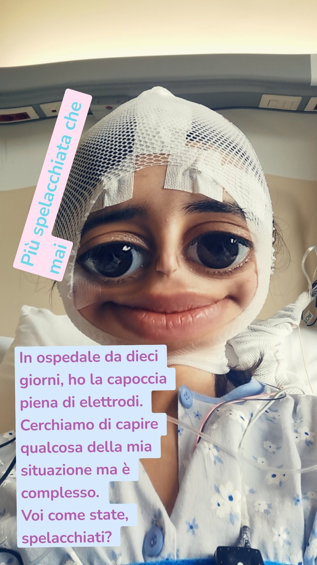 In ospedale da dieci giorni, ho la capoccia piena di elettrodi. Cerchiamo di capire qualcosa della mia situazione ma è complesso.
Voi come state, spelacchiati?  Più spelacchiata che mai